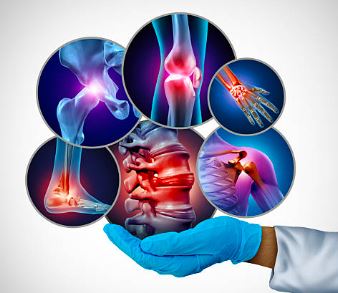 Orthopedics